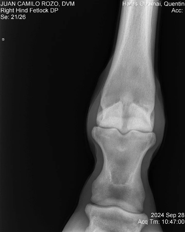 Right Hind Fetlock DP.jpg