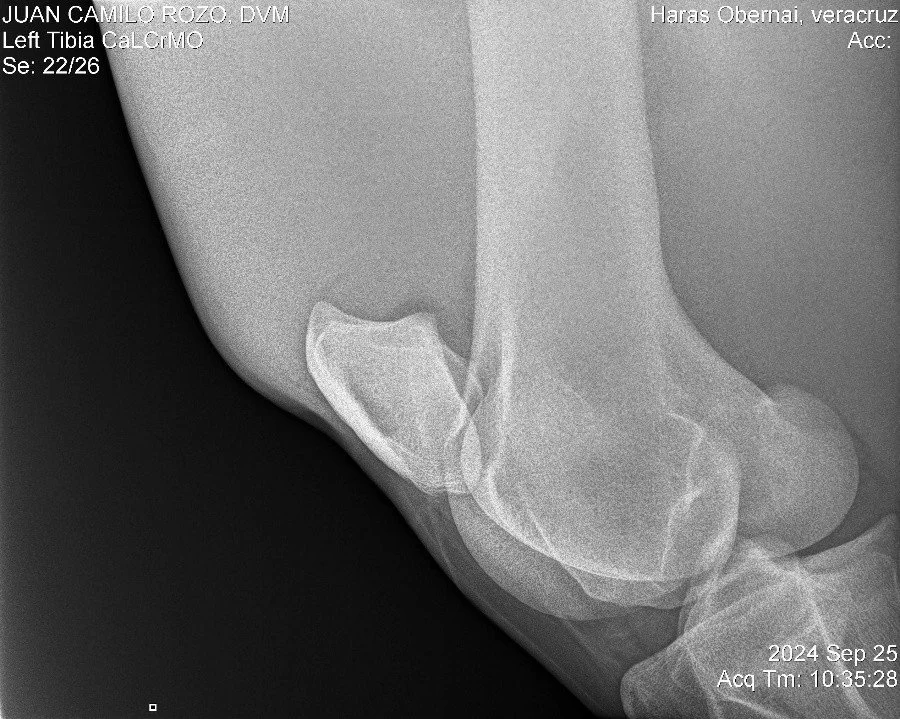 Left Tibia CaLCrMO.jpg