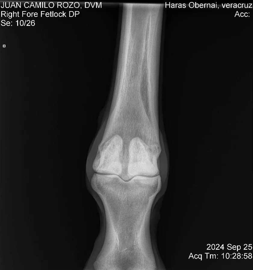 Right Fore Fetlock DP.jpg