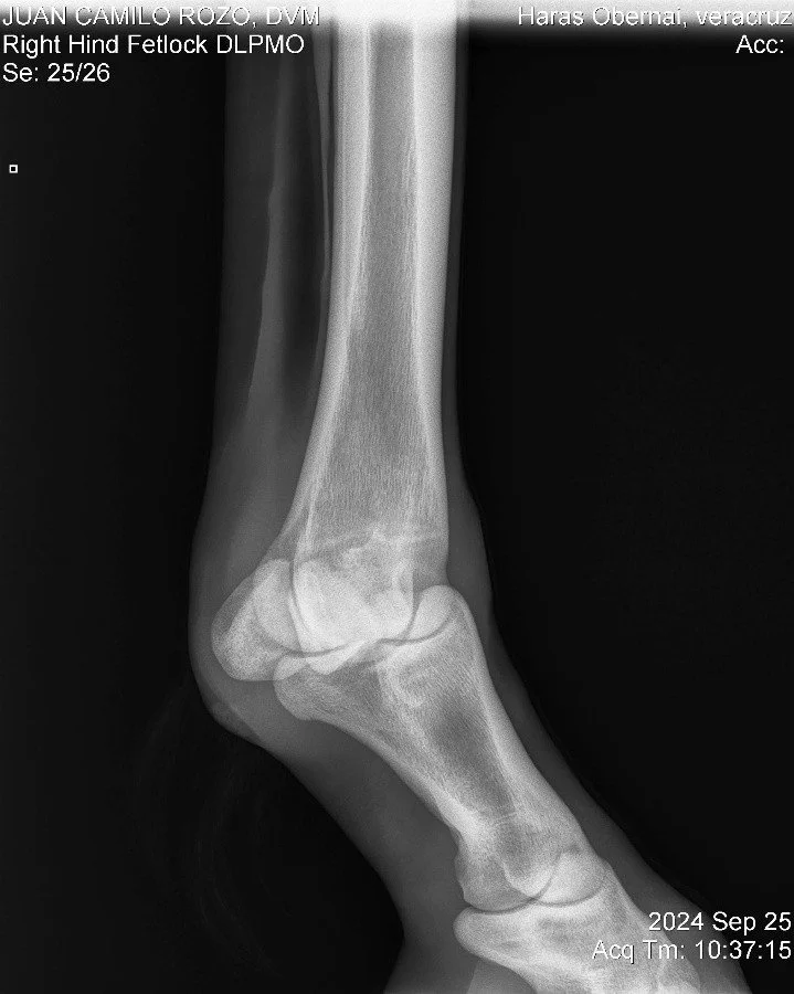 Right Hind Fetlock DLPMO.jpg