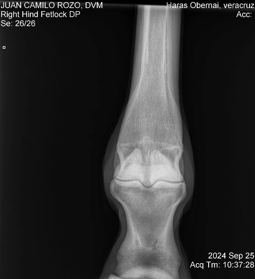 Right Hind Fetlock DP.jpg
