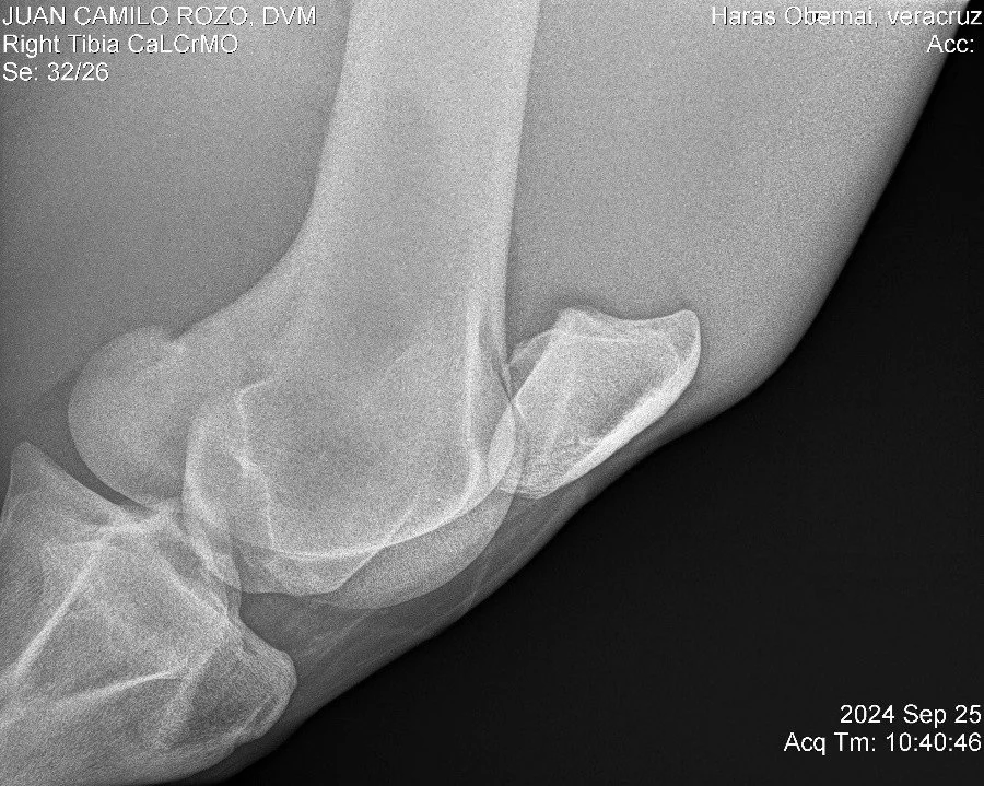 Right Tibia CaLCrMO.jpg