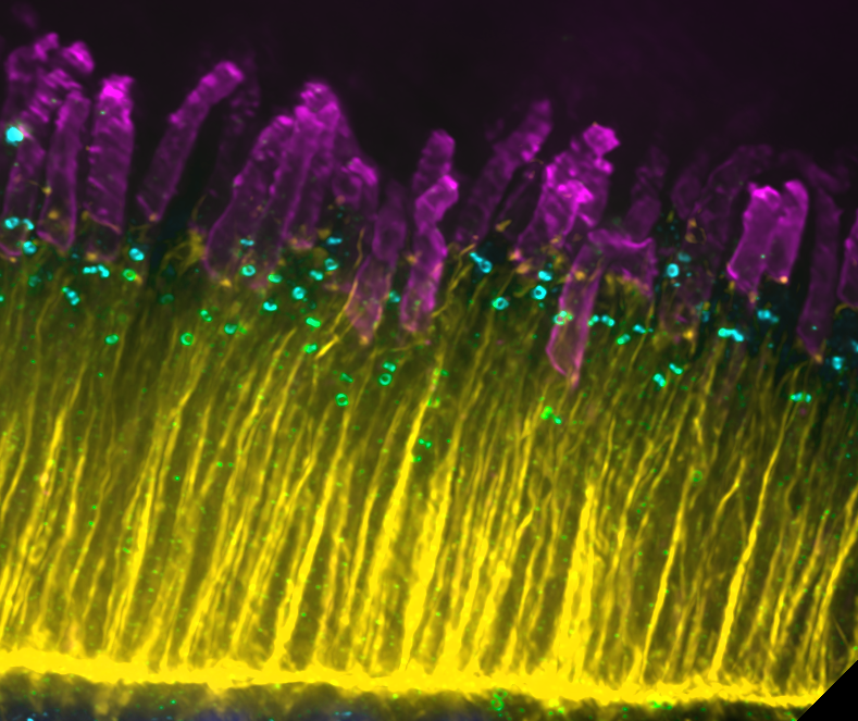 Retina+test+002_Actin+555_FOP+488_Rho+647_scale+5um_cropped.png