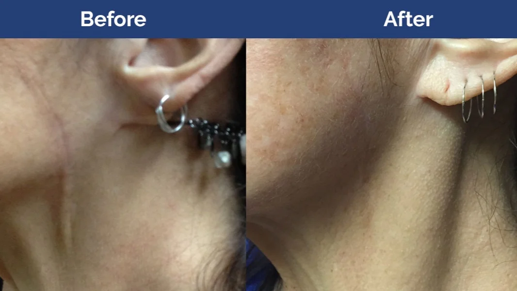 CelSana_Before_After_Website_1.jpg