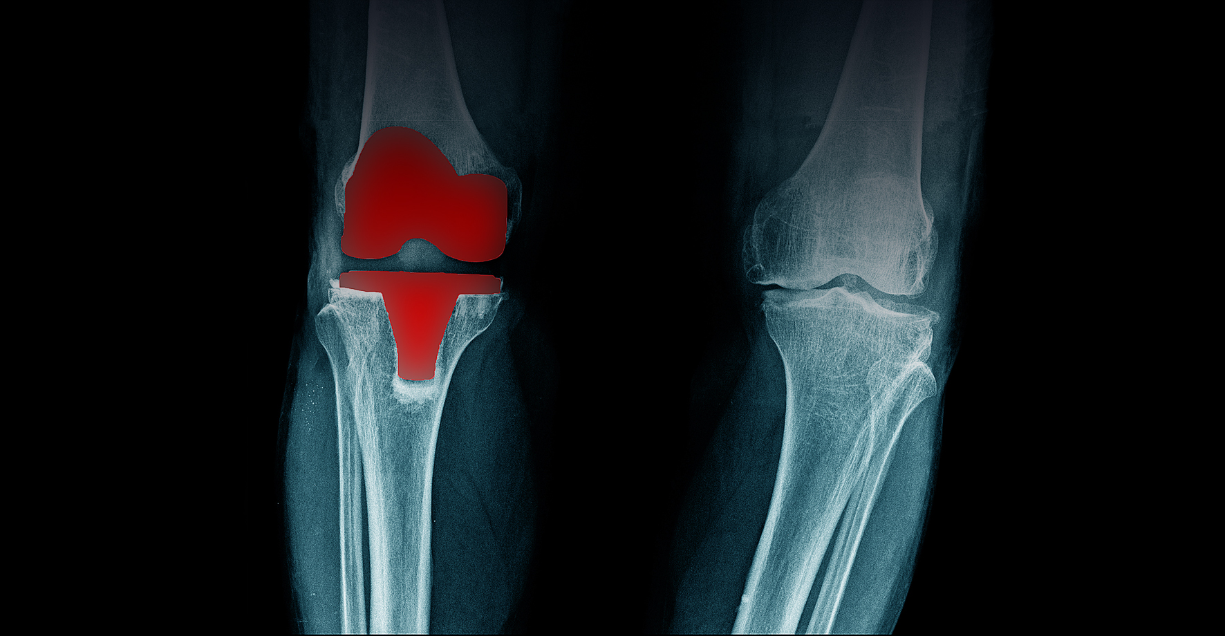 Knee.jpg