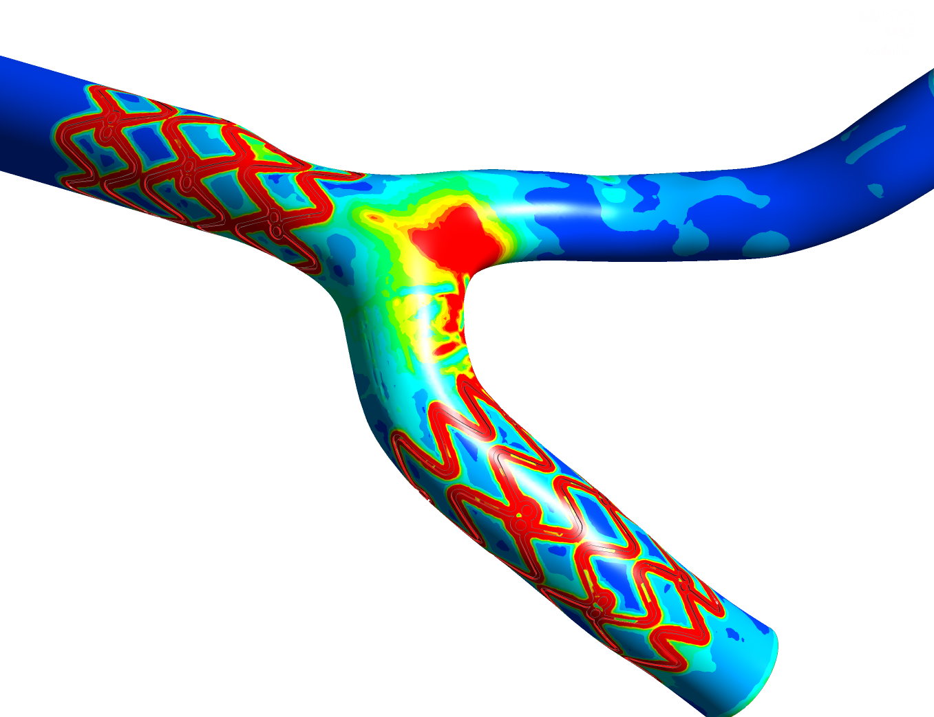 Targeted stent testing  (Copy)