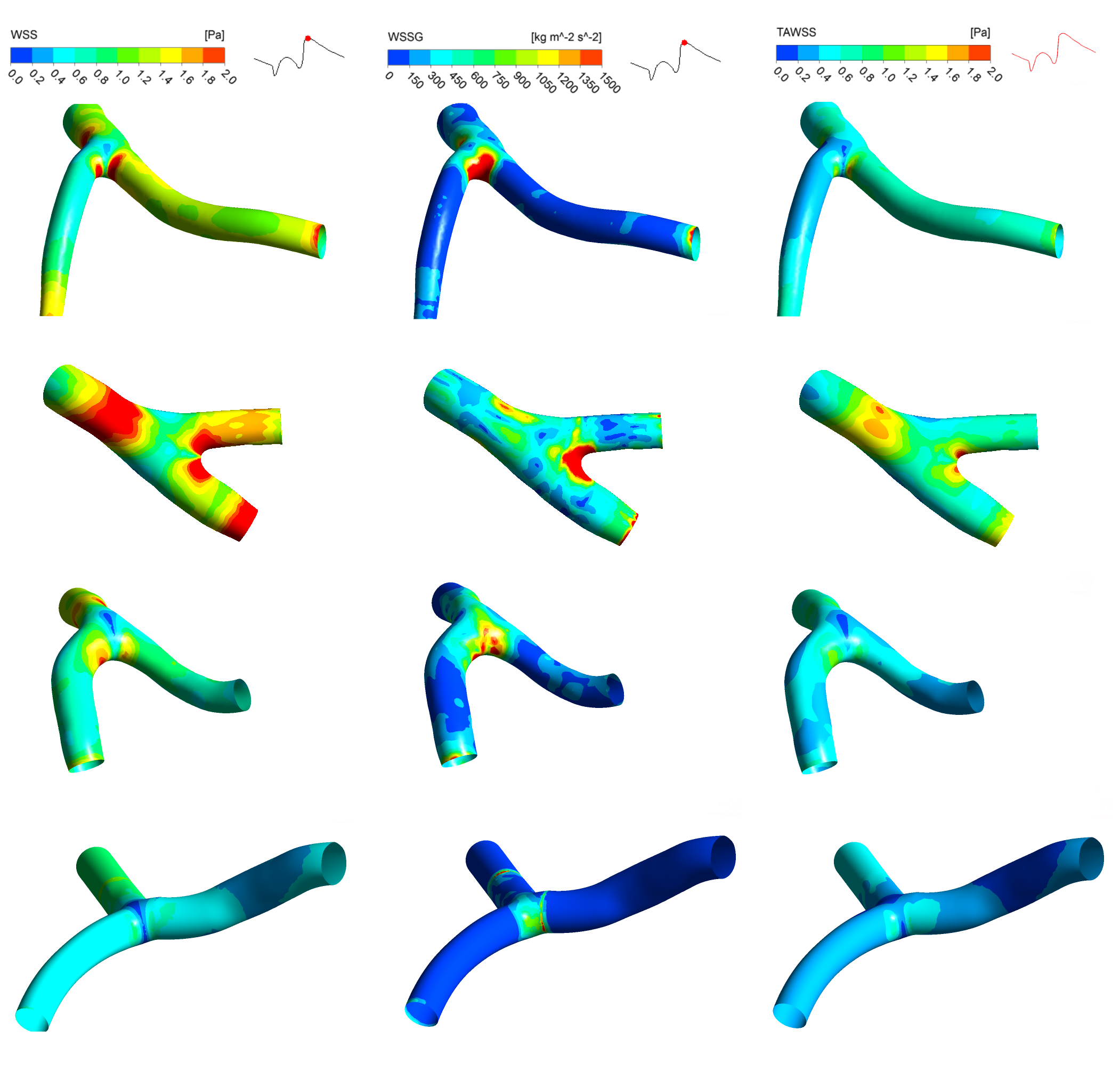 Variety of patient specific coronary artery models and their stress contours