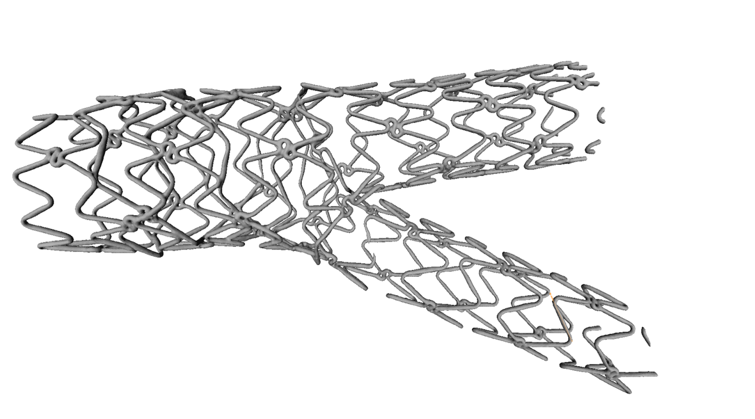 reconstructed deployed stent for cardiovascular health research