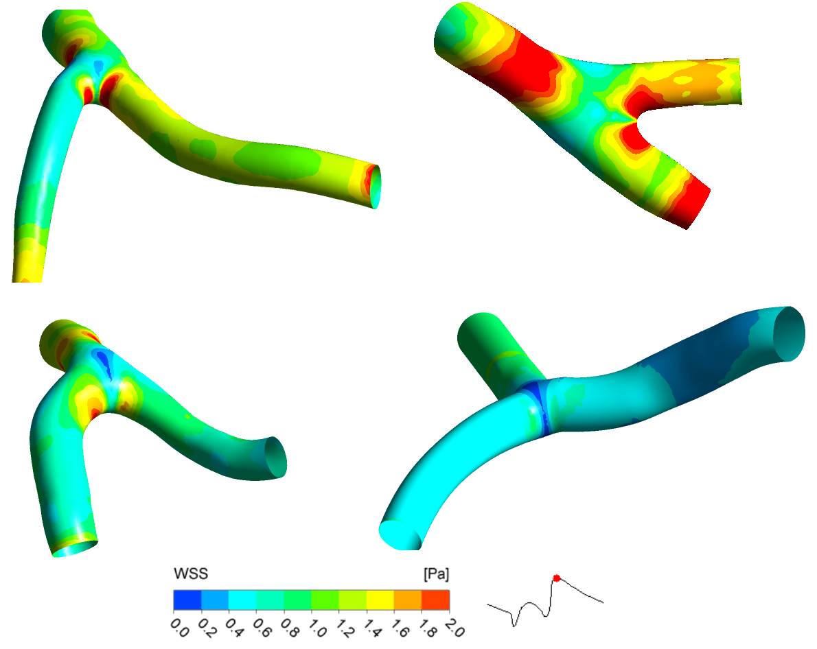 Coronary blood flow populations