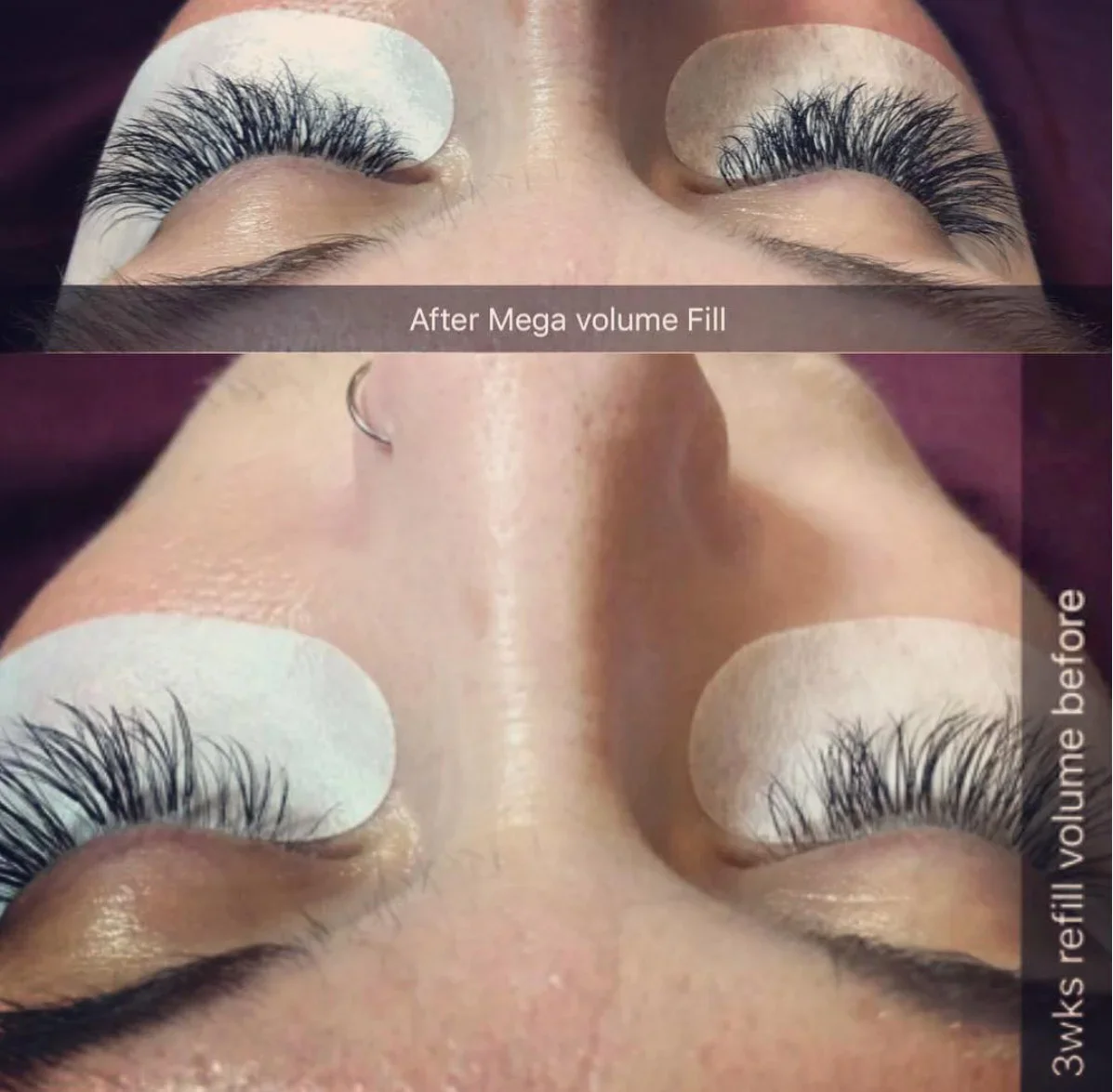 Mega Volume Fills Before &amp; After