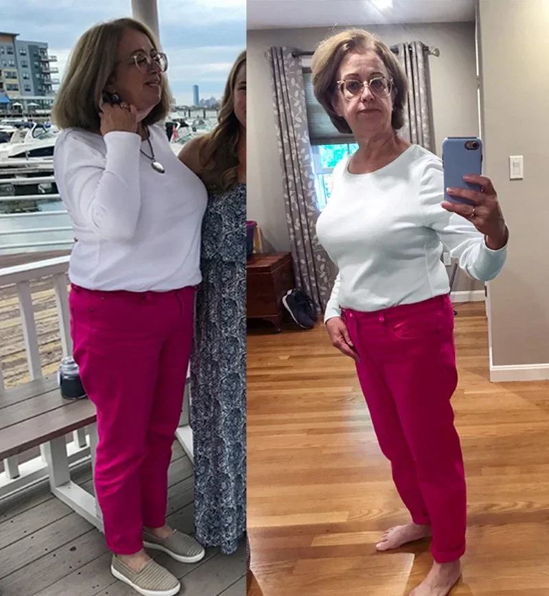 Before_After_Weightloss_Client_Story_Patsy_Stoney.webp