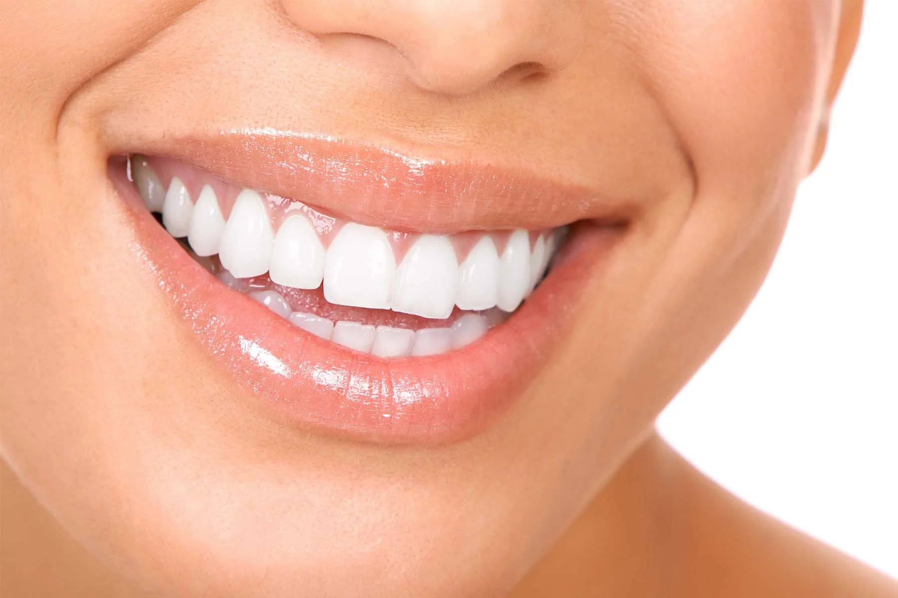 Teeth Whiteing In Heber City