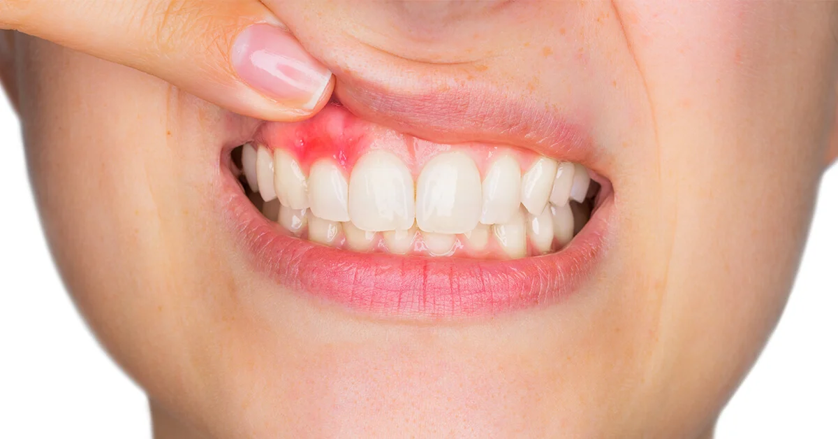 toothache-2.jpg