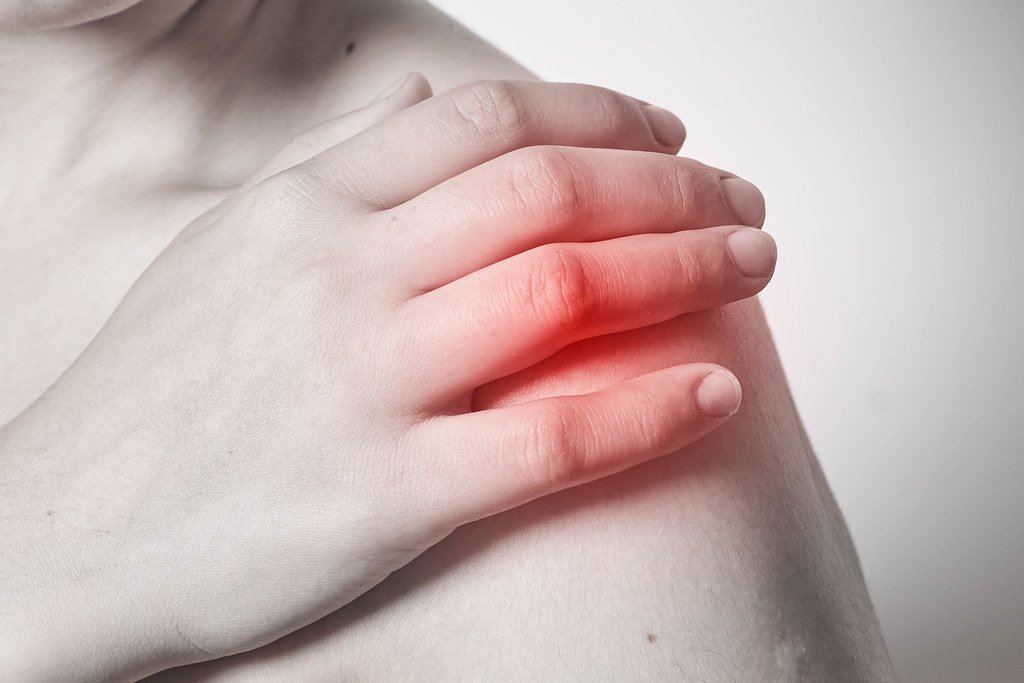 Post Exercise Soreness