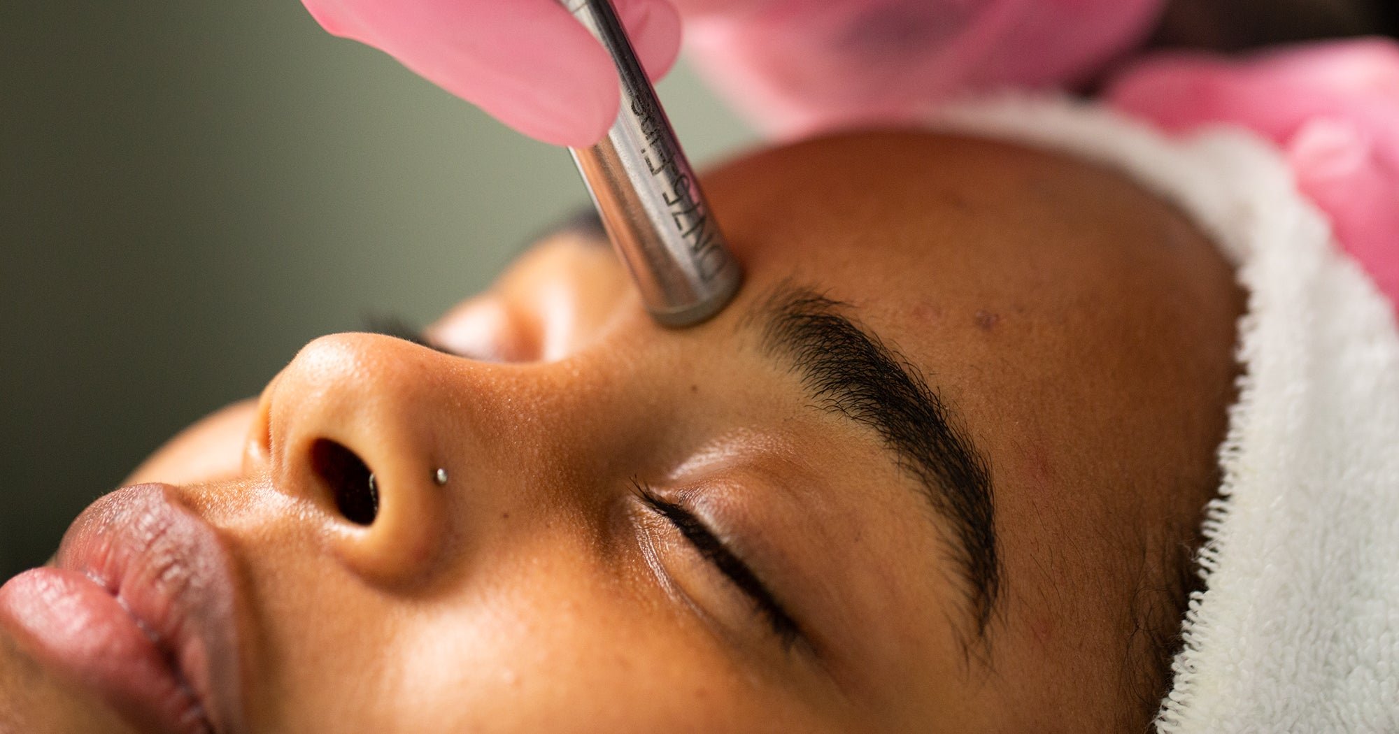 Micro Dermabrasion - Single Treatment
