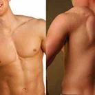 Back & Chest Combo $80.00