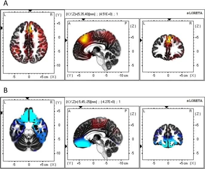 New Paper in Nature Scientific Reports
