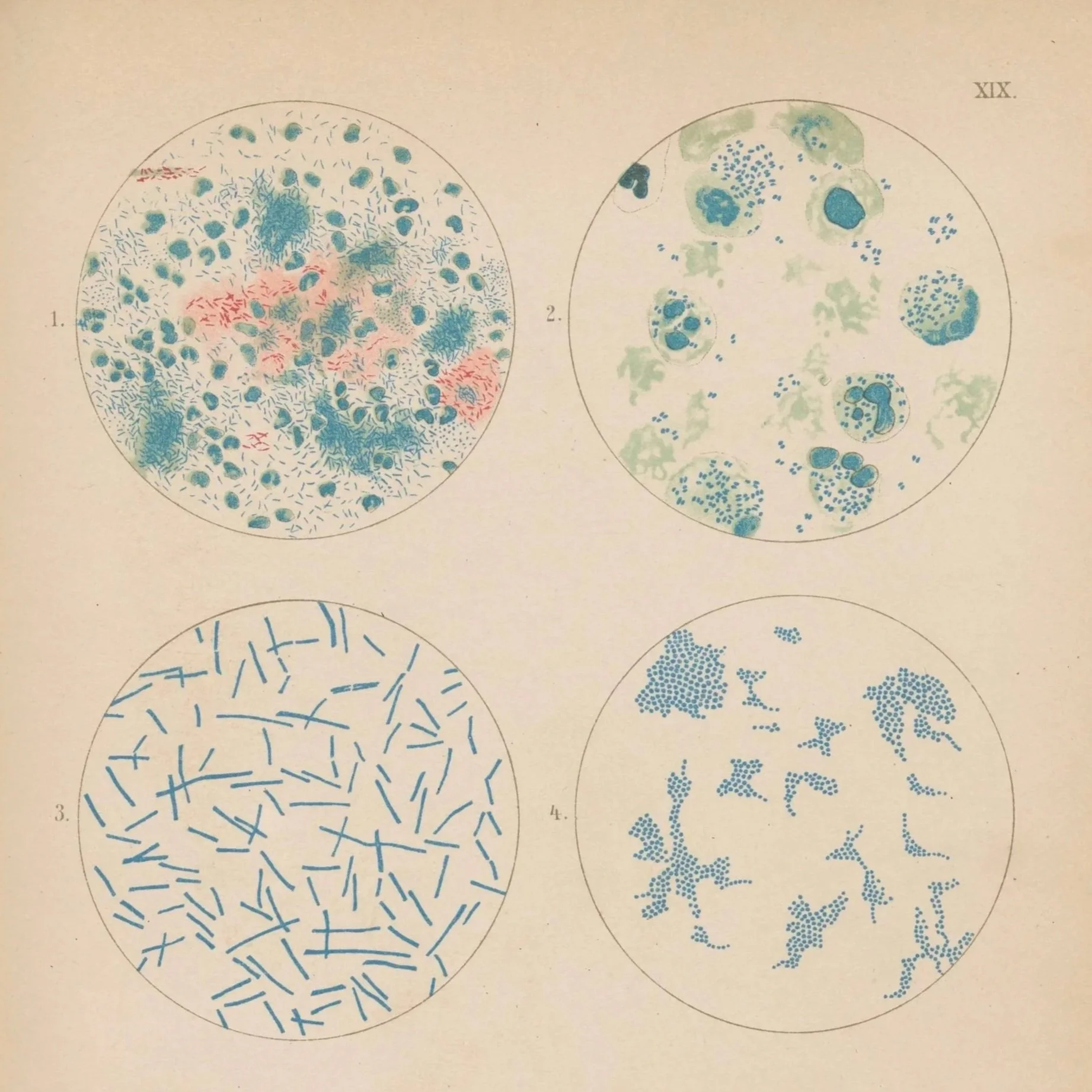 plate_xix_tubercle_td96k355j_0_j098zb97k_download_full.jpg
