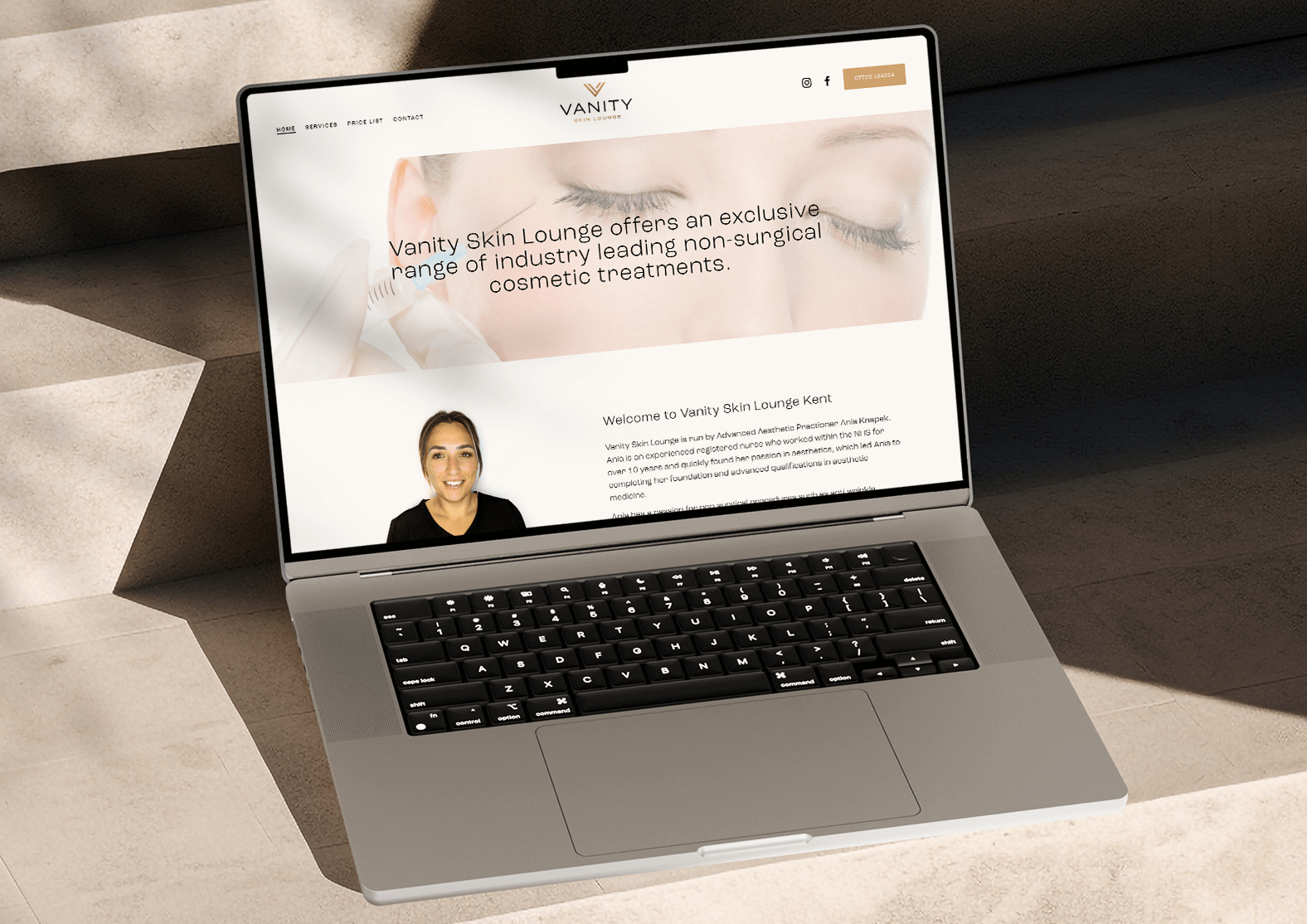Open laptop on beige textured surface displaying the homepage of Vanity Skin Lounge, with text about cosmetic treatments, a photo of a smiling woman, and a background image of closed eyes with skincare treatment.