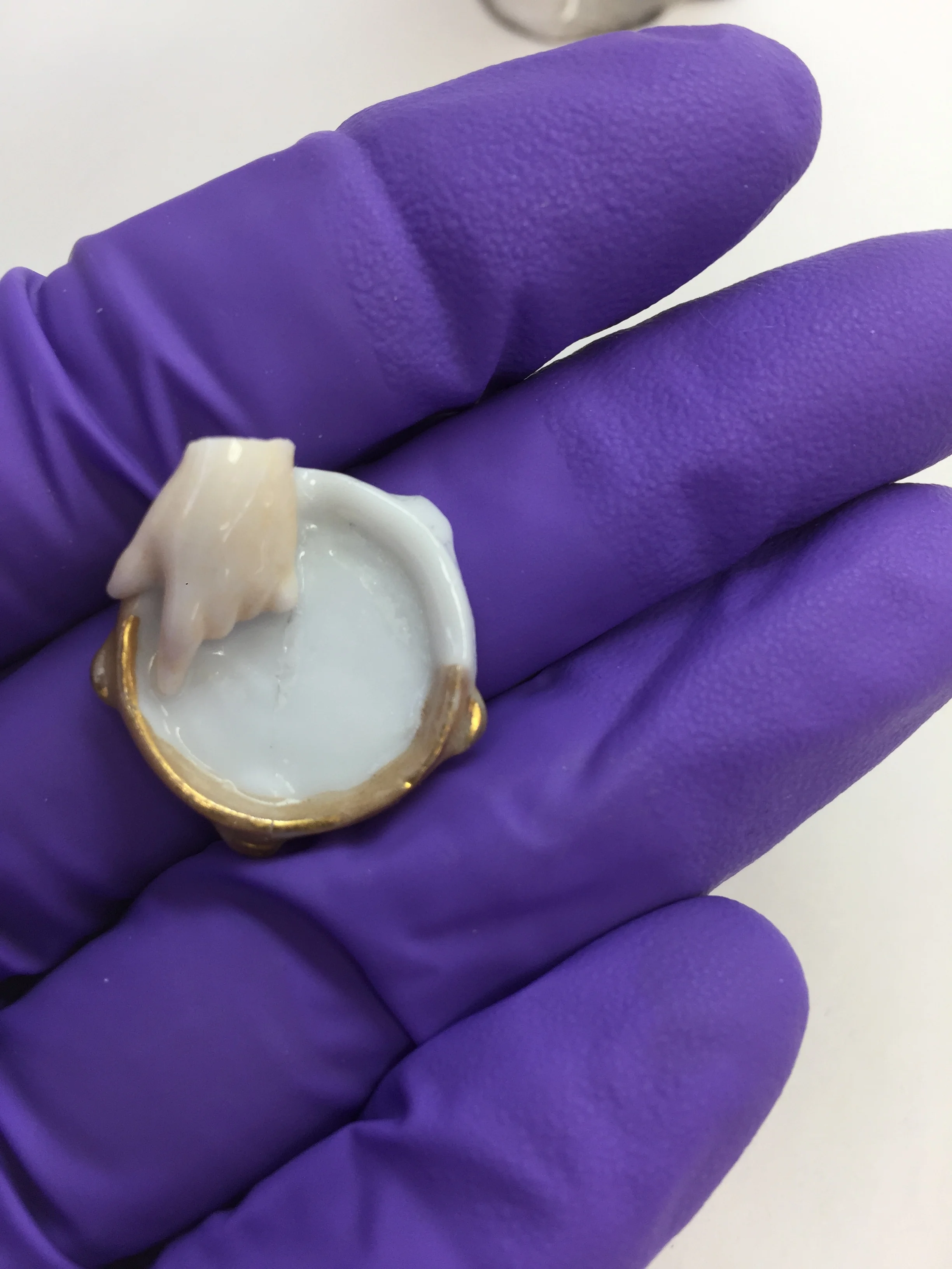  The missing half of the tambourine was repaired by molding and casting tinted epoxy into the area of loss. 