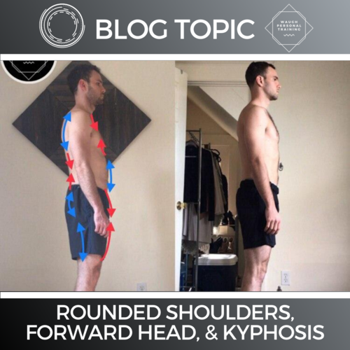 Rounded Shoulders, Forward Head, And Kyphosis, Oh My! - How To Fix