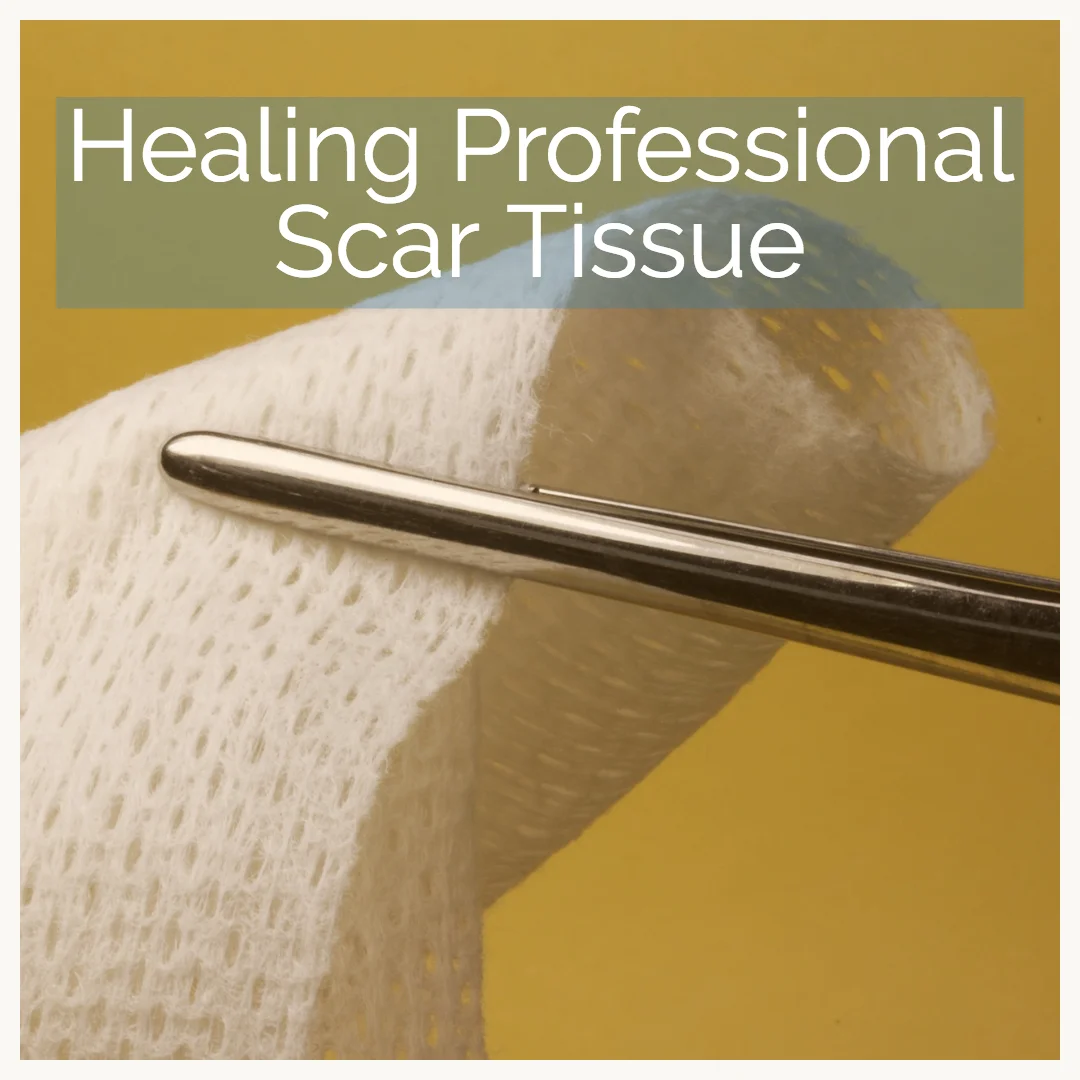 The painful truth about professional scar tissue.