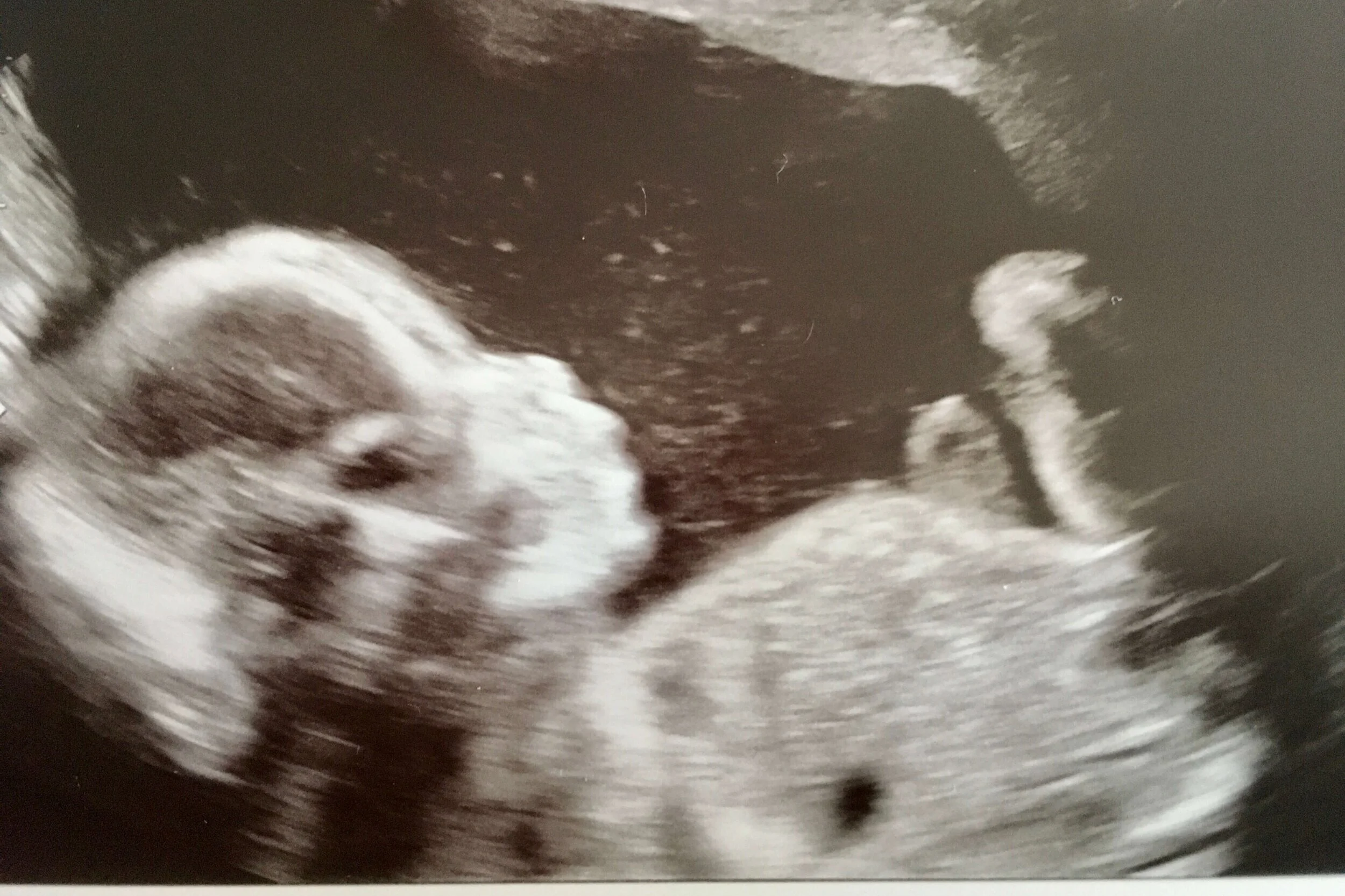 Baby+Eco+Nov+3_2020+%281%29.jpg