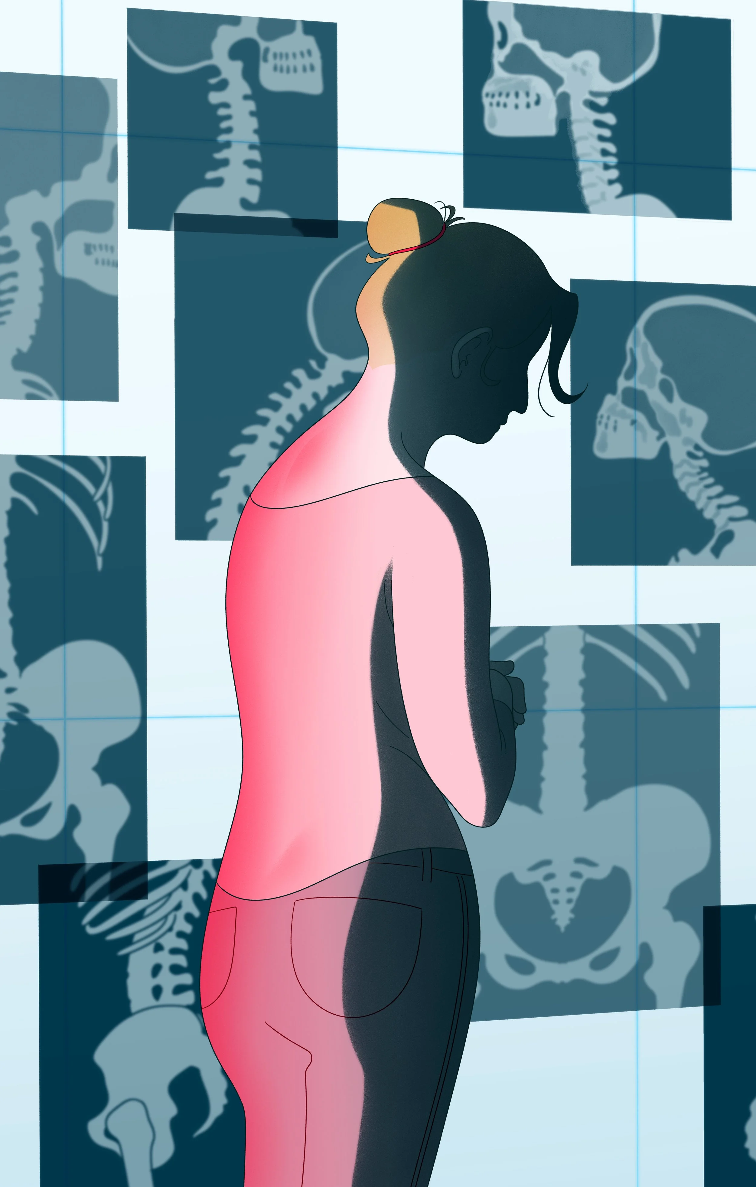 "Medical Mystery: A high-schooler with hip pain, then a life-threatening diagnosis" Credit: Bianca Bagnarelli for The Washington Post