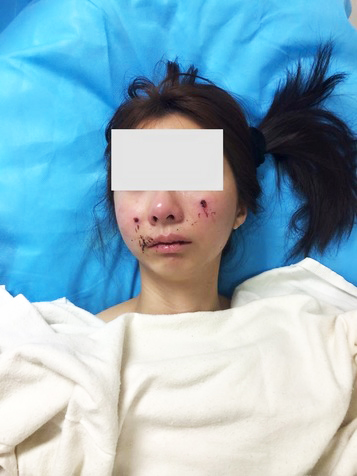 human-abuse-victim.jpg