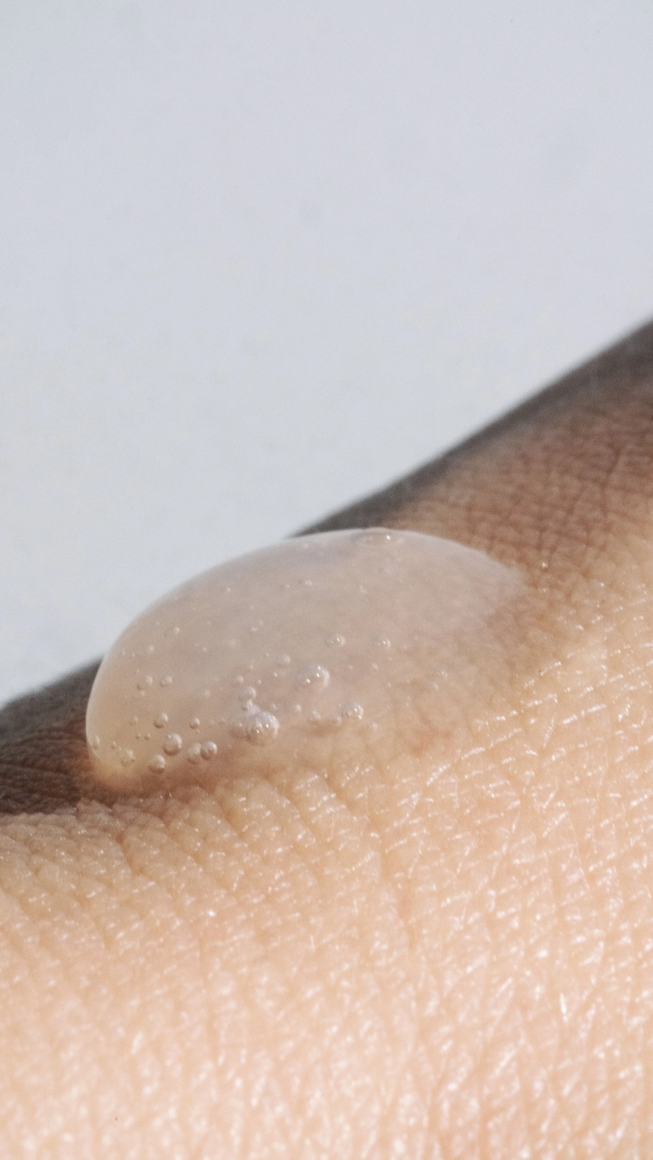 Niacinamide gel moisturiser support.jpg