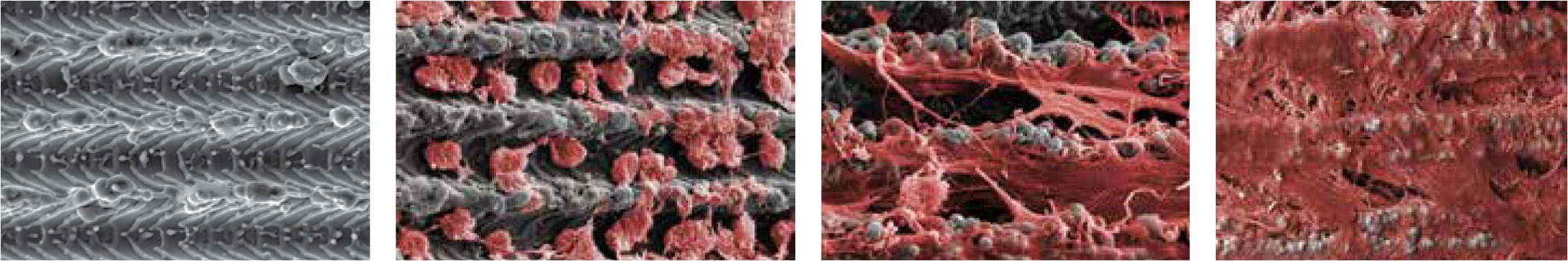 Imagen tomada con microscopio electrónico de la superficie del implante integrándose con el hueso.