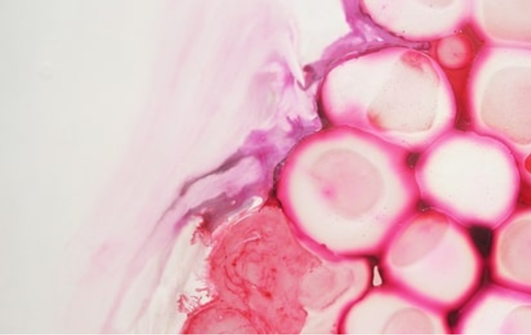 detail, Suzanna Fields: Bubble n Drawl, 2011