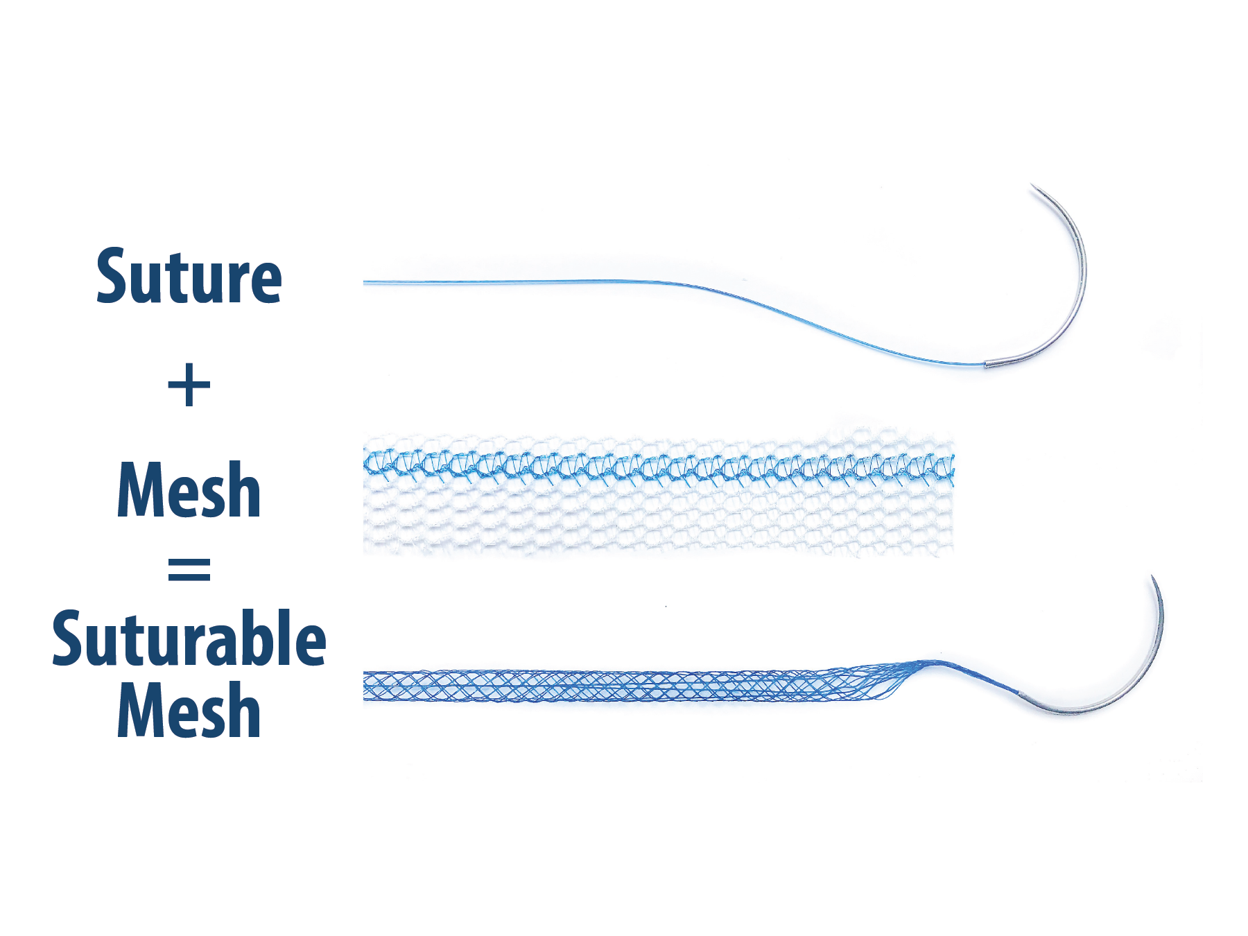 Suturable Mesh Equation 2-01.png