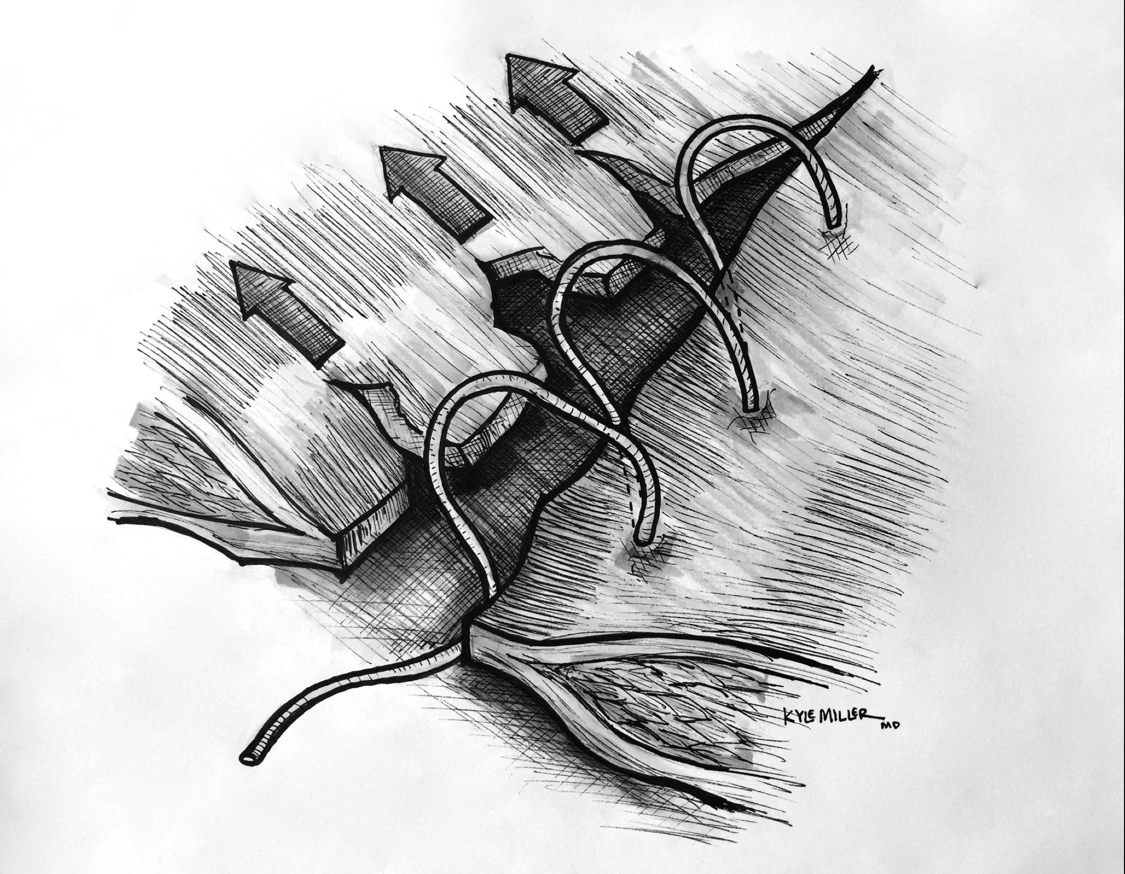 Suture Pull Through.png