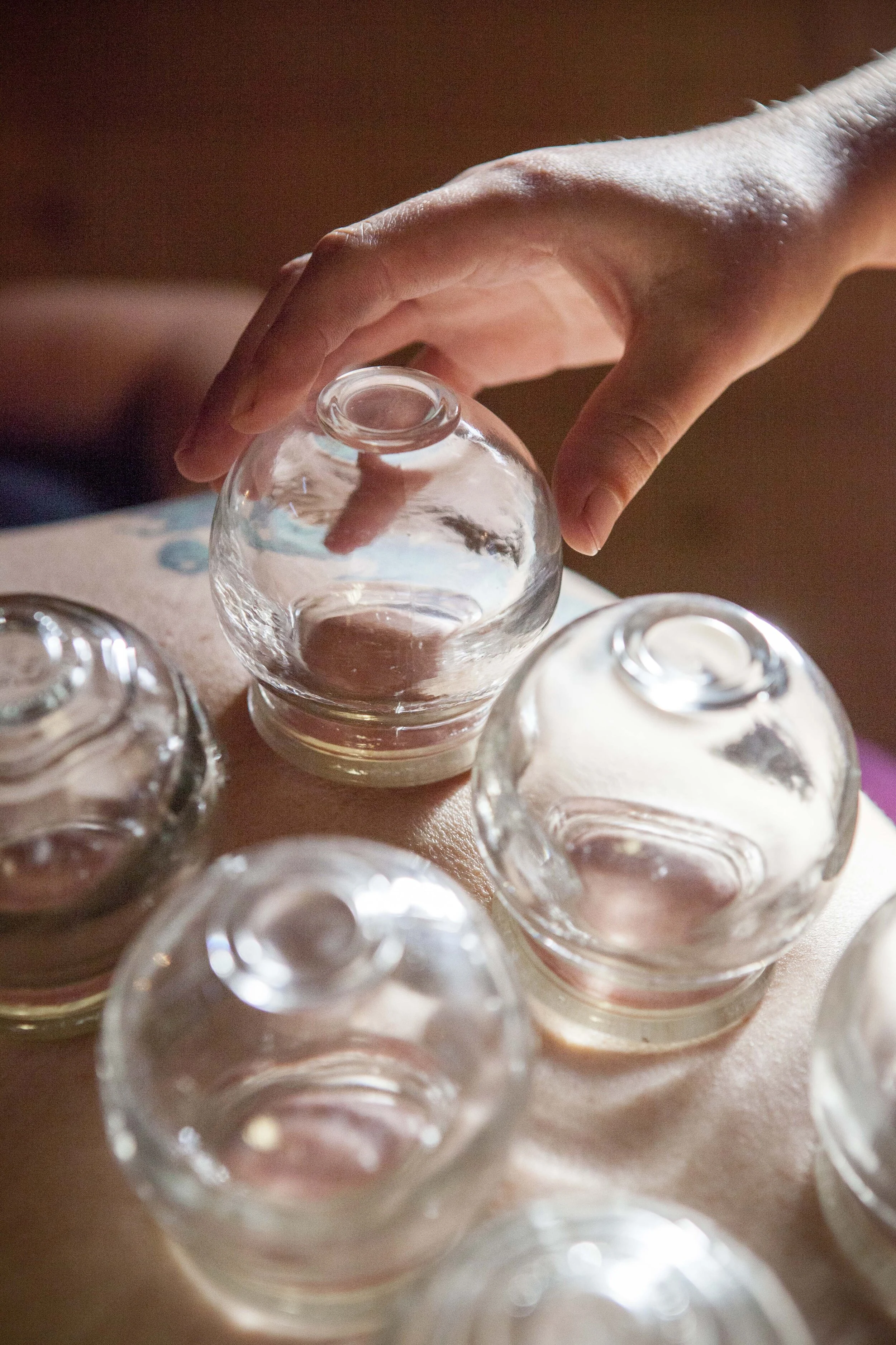 Postpartum Acupuncture 