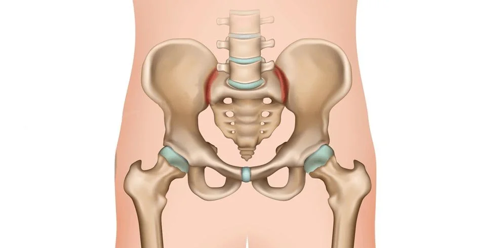 SI Joint Fusion Treatment