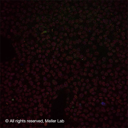 © all rights reserved, Meller lab.