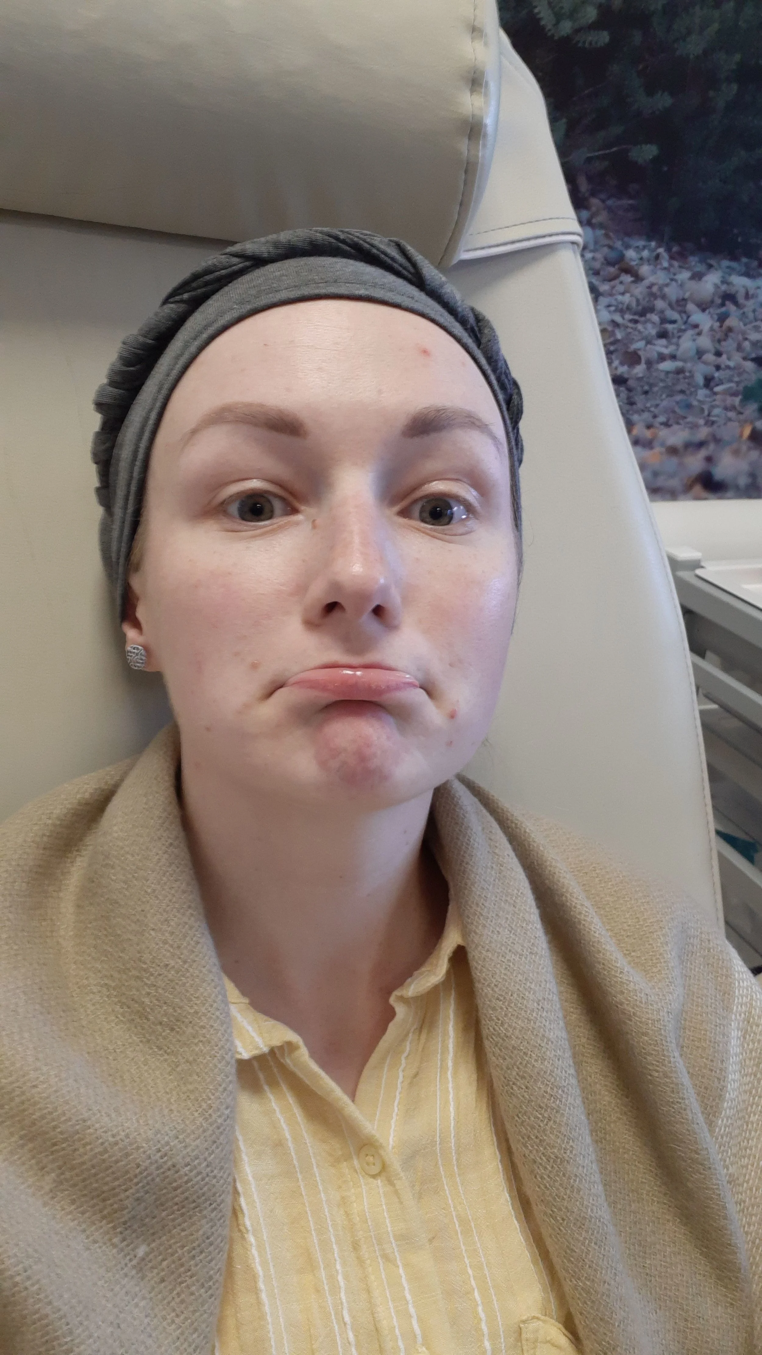 Jade at chemotherapy