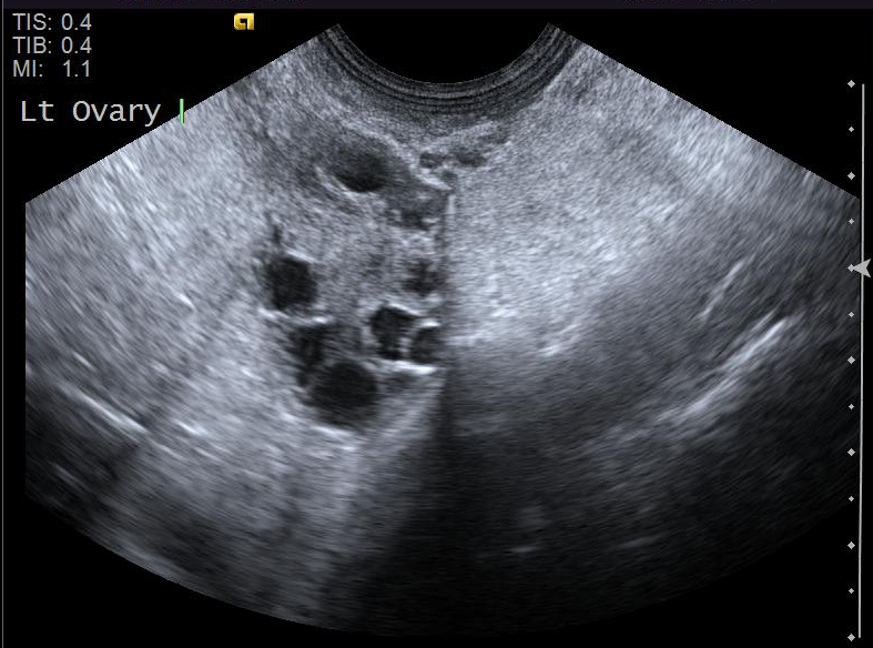 Ultrasound.png