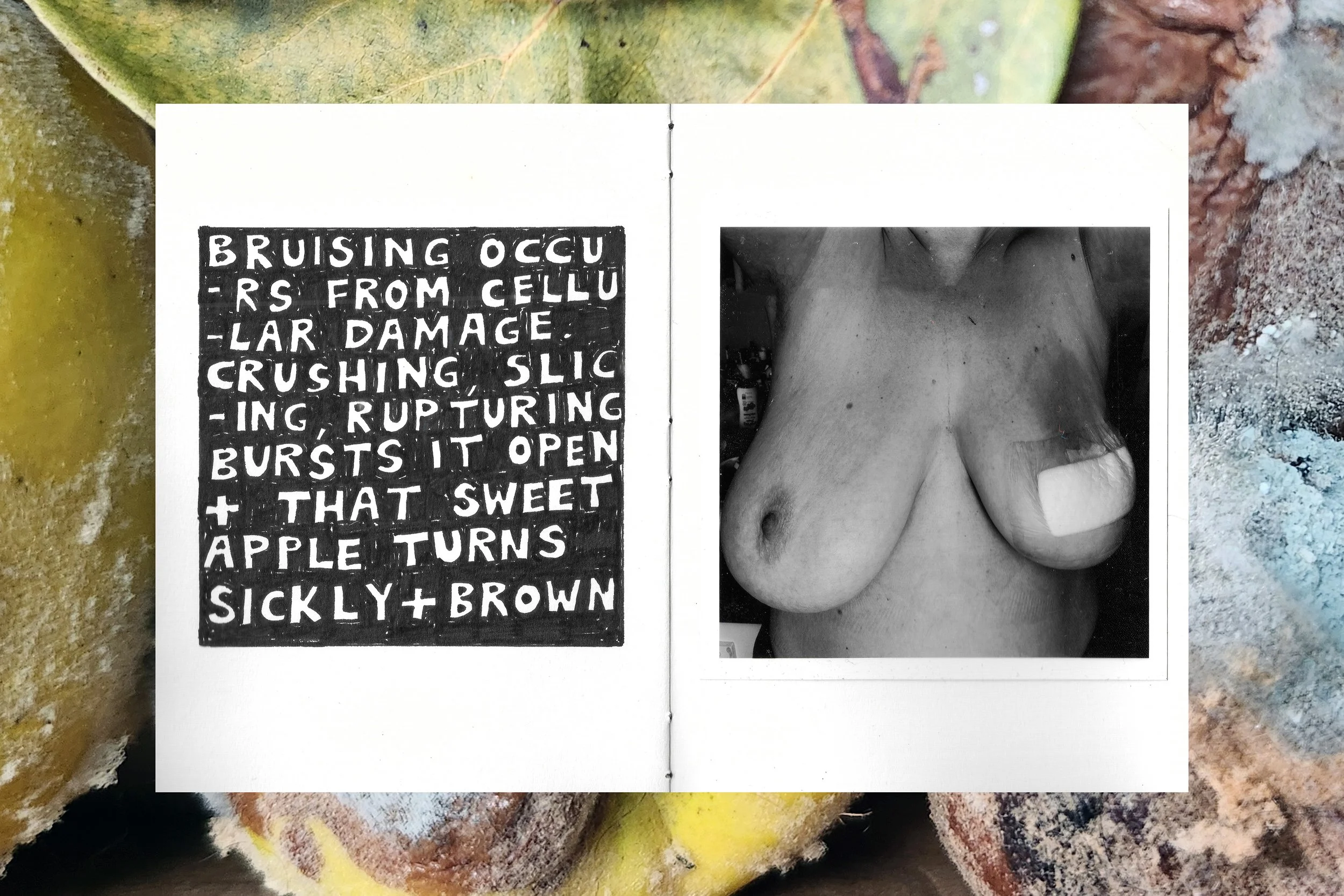 Tumours and Tubers, Anne Steves