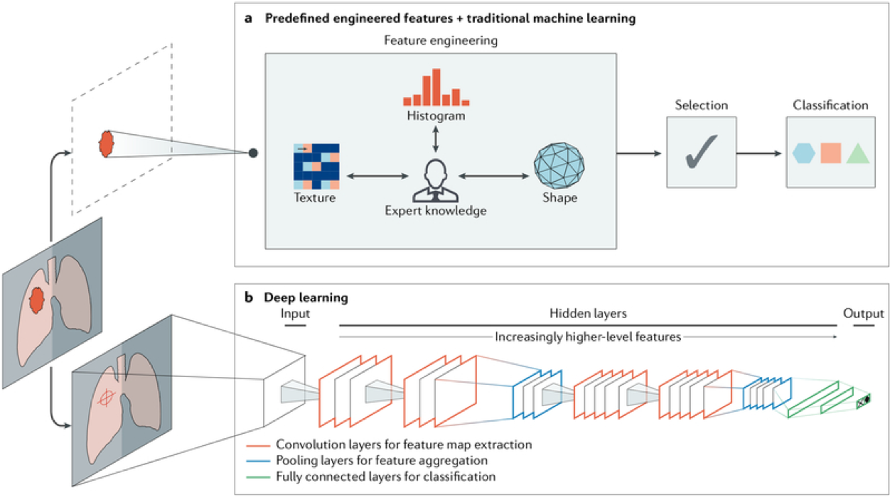 Artificial intelligence methods in medical imaging. This schematic provides an outline for two AI methods for classifying image data, when diagnosis objects as either benign or malignant. a) The first method uses features of cancer extracted from regions of interest on the basis of expert knowledge. Such features include tumour volume, shape, texture, intensity and location. From this the most robust features become machine learning classifiers i. b) The second method relies on deep learning and does not require annotating of specific regions, but has knowledge of the types of tumours based on localisation. The neural network has several layers that enable classification to be learnt during training - this is very much the model Microsoft’s Inner Eye system is based upon. https://www.ncbi.nlm.nih.gov/pmc/articles/PMC6268174/#BX1
