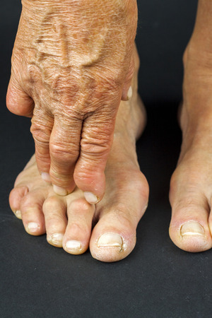 Listen to Your Feet for the Early Warning Signs of Heart Disease