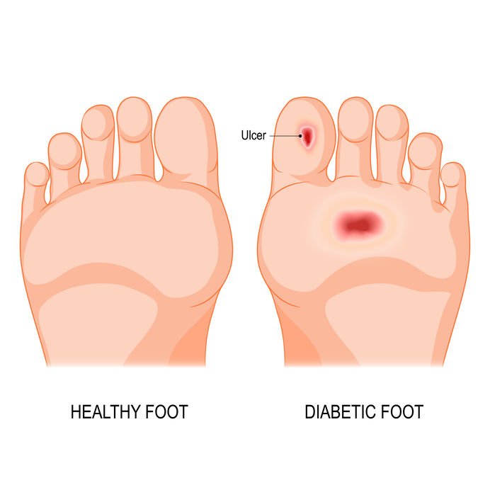 10 Interesting Feet Facts - Foot Comfort Centre