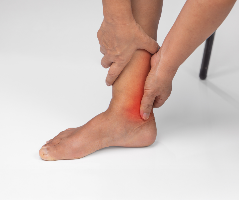 4 Causes of Achilles Tendonitis That Aren’t Running