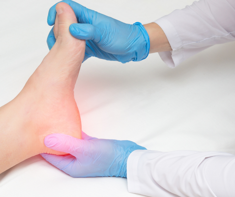 What Are Heel Spurs, and Do You Have One?