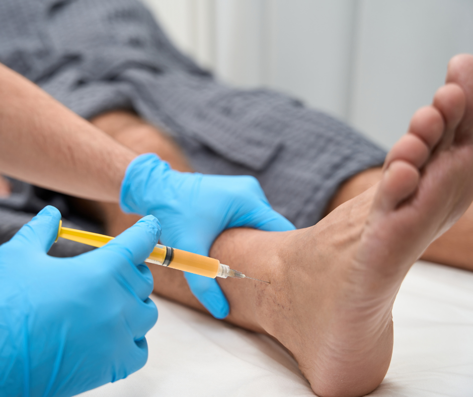 PRP therapy in foot