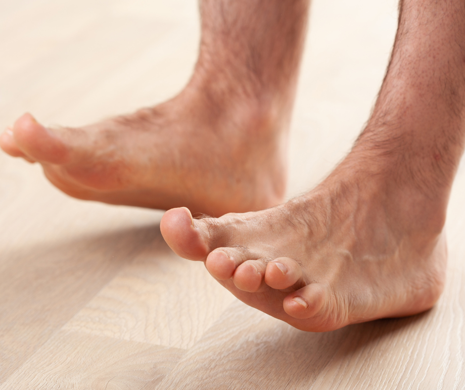 Why Is My Toe Bending? 