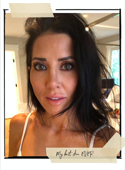 nataliestrahorn_laserfacials_Sandraoulmas_3.png