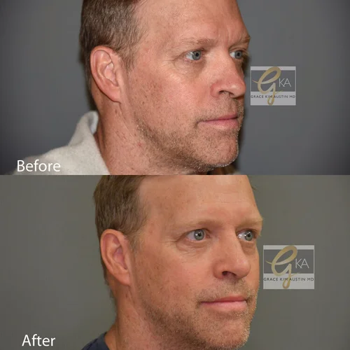 Gallery — Facial Plastic Surgeon - GRACE KIM AUSTIN MD Gallery — Facial Plastic Surgeon - GRACE KIM AUSTIN MD