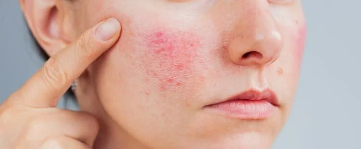 Skin Rash Explained: Causes, Symptoms & When to See a GP — GP24: The 24 ...